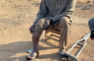 BENIN | APR. 03, 2023 — Pastor’s Leg Broken by Voodoists