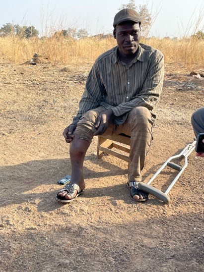 BENIN | APR. 03, 2023 — Pastor’s Leg Broken by Voodoists