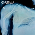 Picture5_KOR